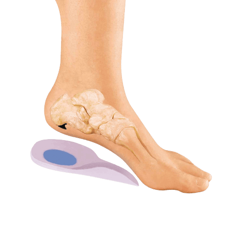מדרס סיליקון לגיד אכילס עם תמיכה לקשת הרגל | מידה S | מסייעת בהפגת הכאב והלחץ על כפות הרגליים | אוריאל | URIEL